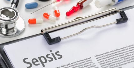 diagnosis and treatment of sepsis