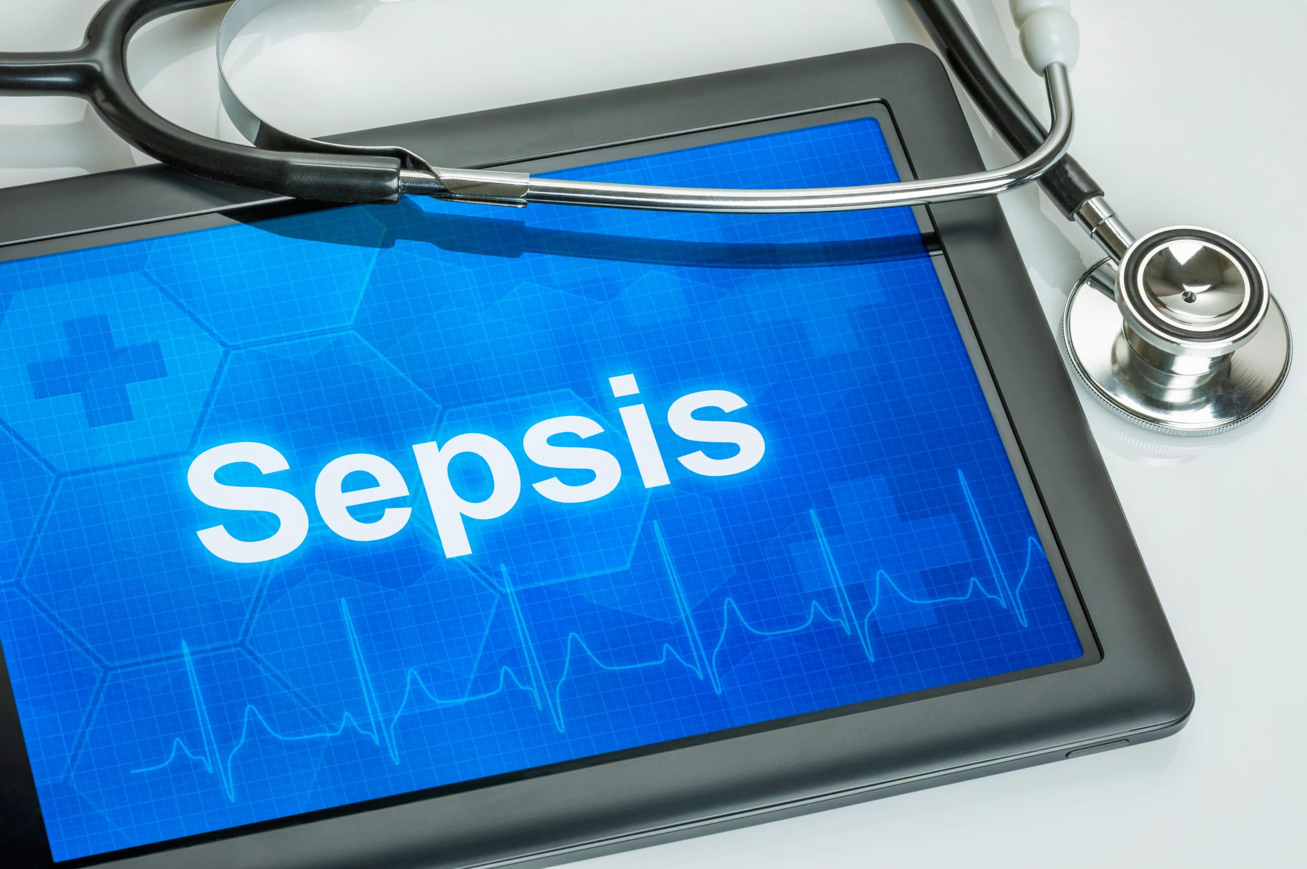 risk factors for sepsis