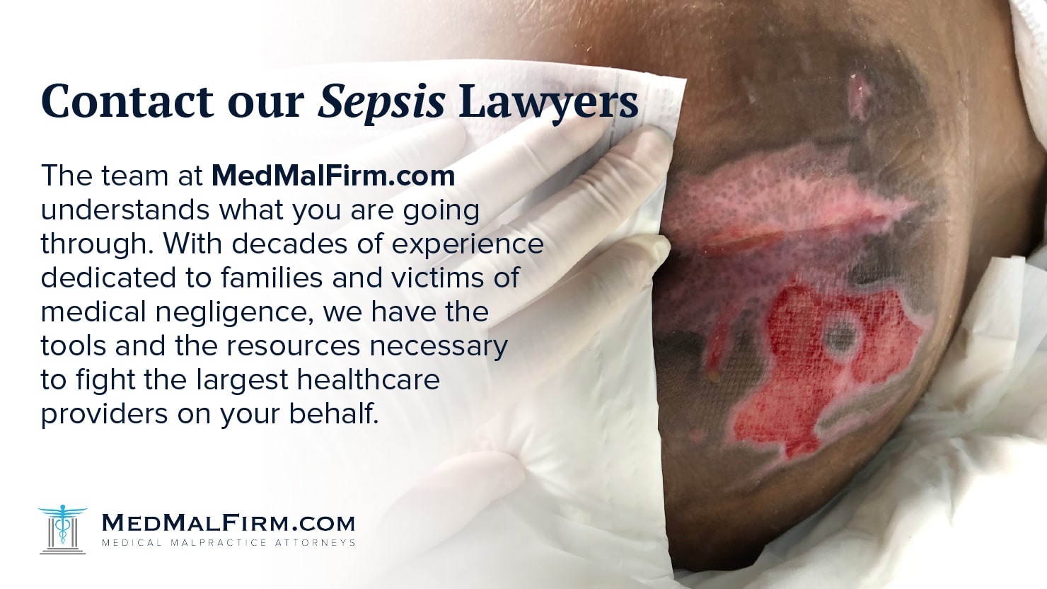 Houston Sepsis Lawyers