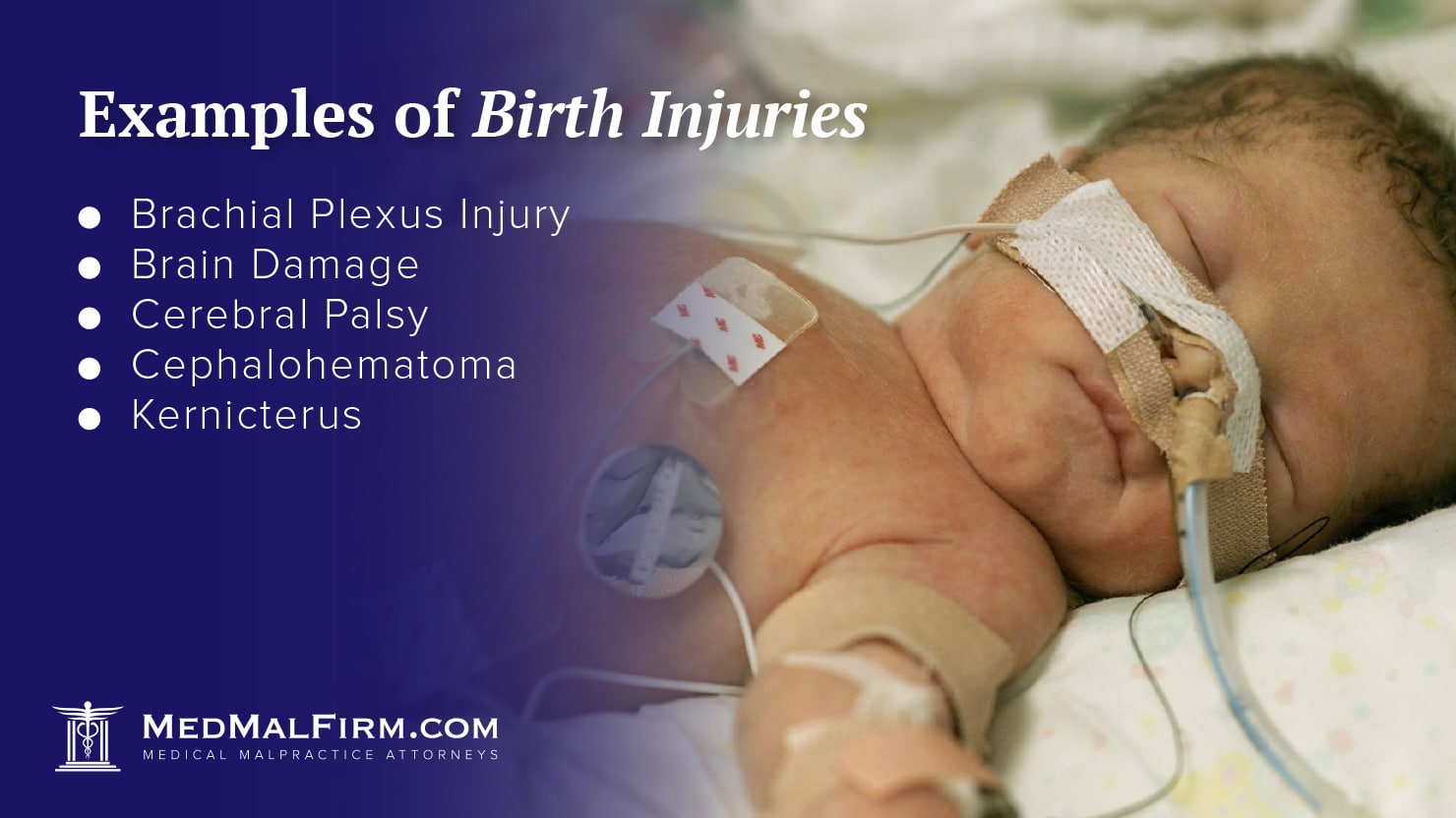 Examples of Birth Injuries