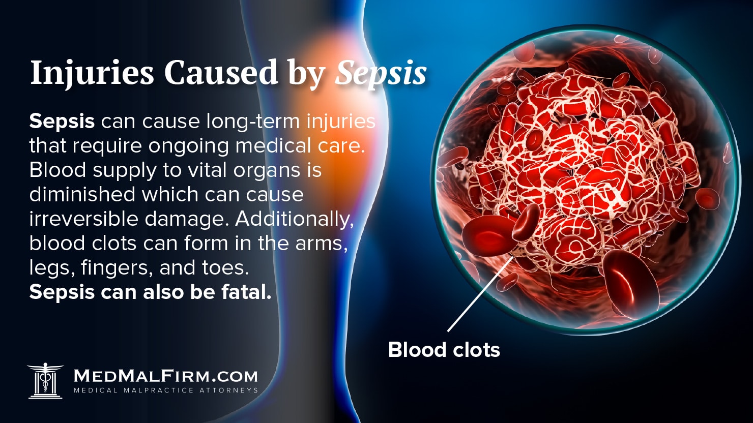 Injuries Caused by Sepsis