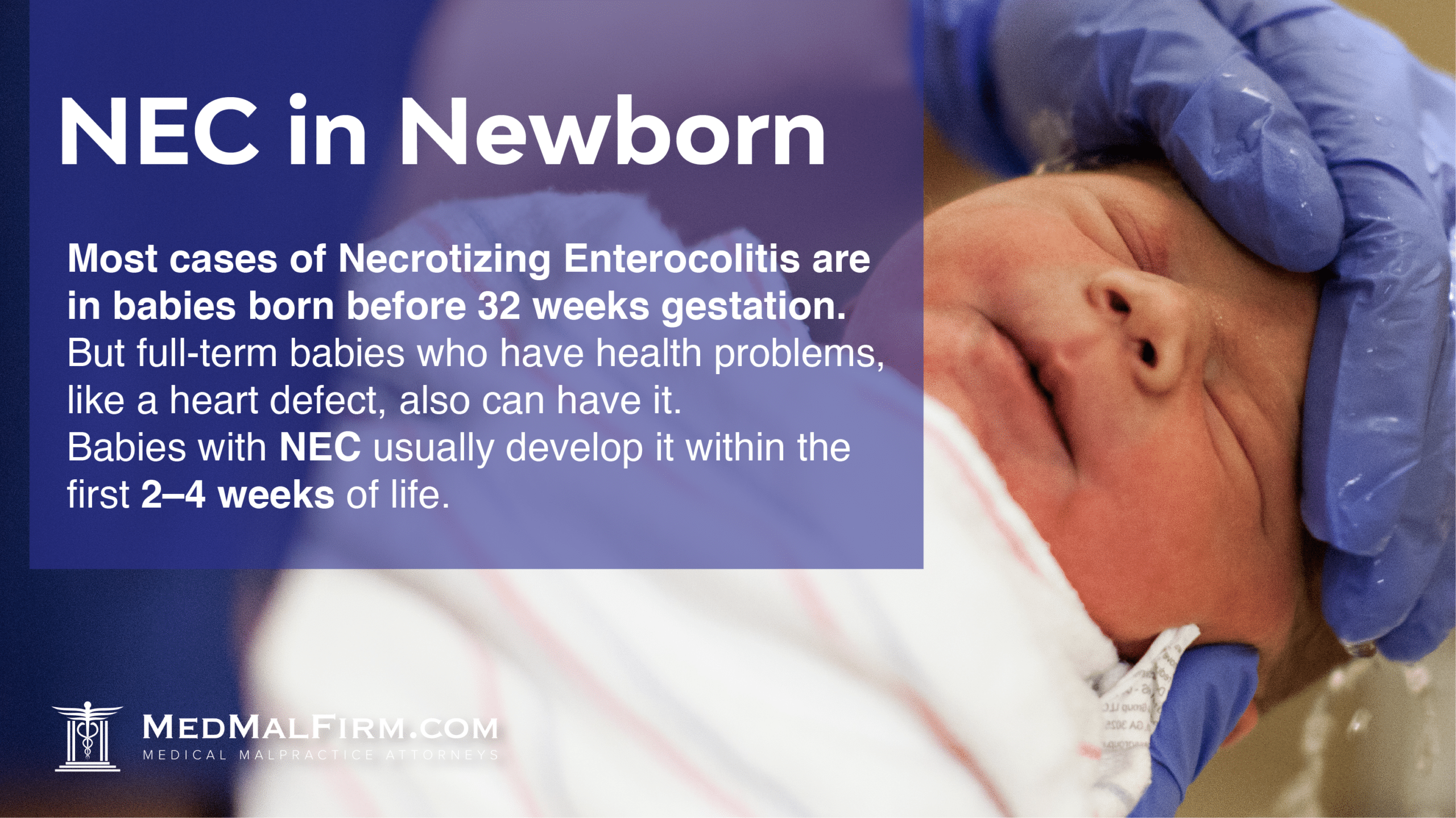 NEC in newborn