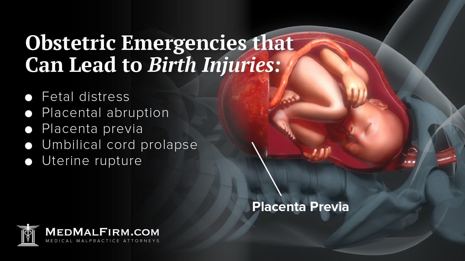 Obstetric Emergencies that Can Lead to Birth Injuries